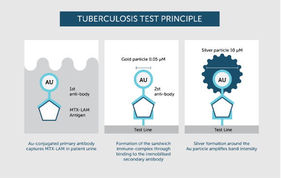 tuberculosis Test Principle - Silver plays an important role. Silver in medicine.
