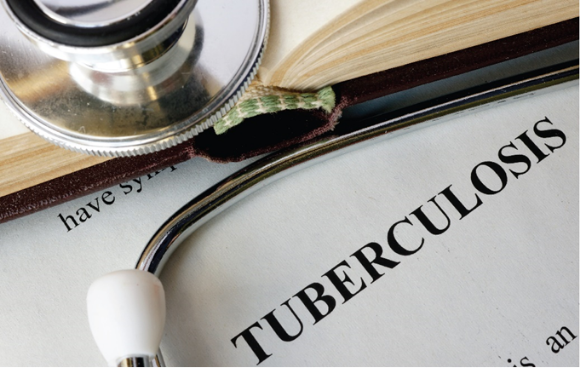 Silver in medicine is critical to keep instruments clean